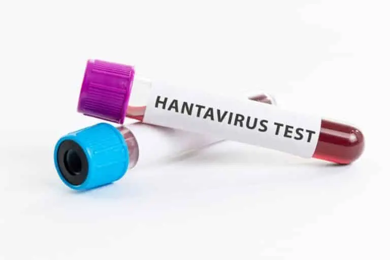 Hantavirus