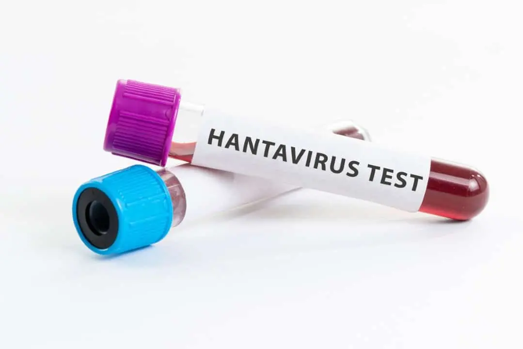 Hantavirus