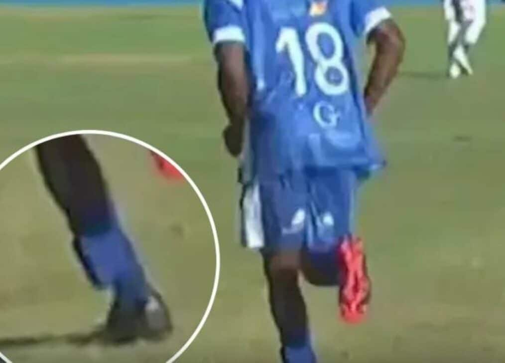 Jogador com tornozeleira