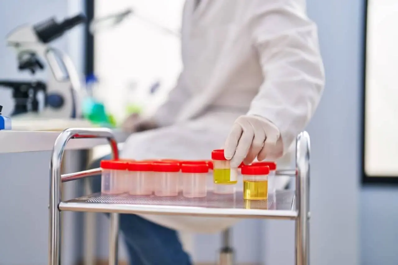 Laboratório, teste, urina