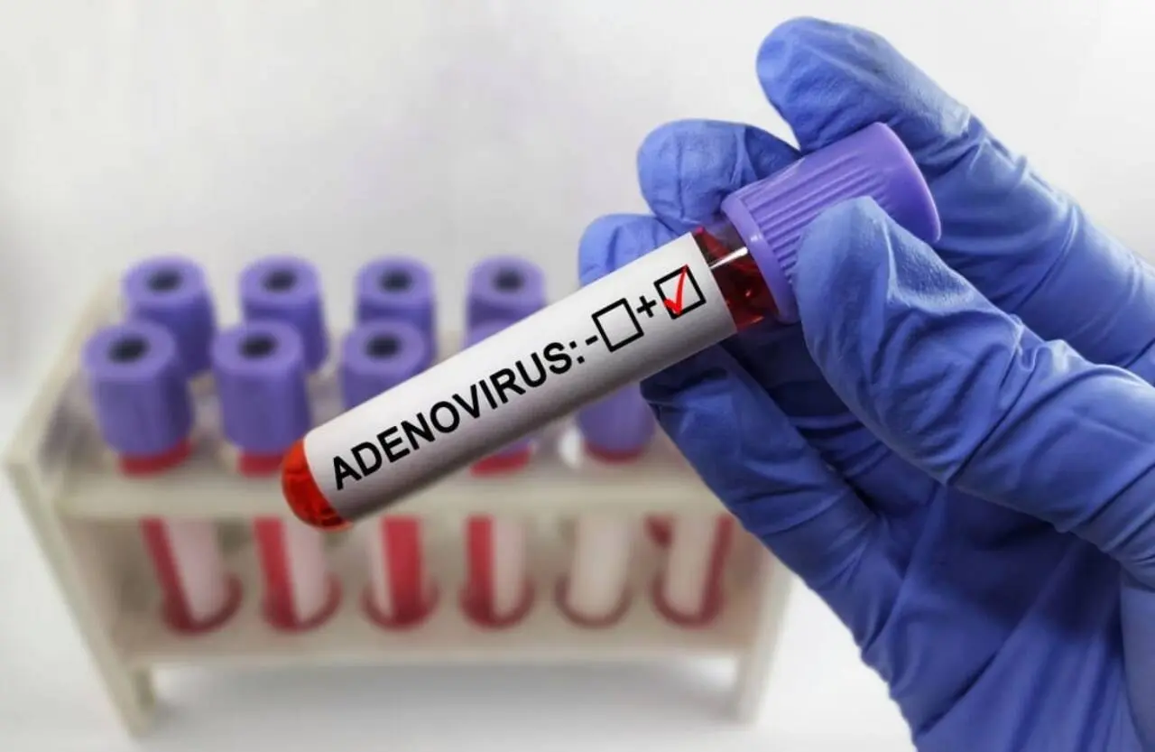adenovirus