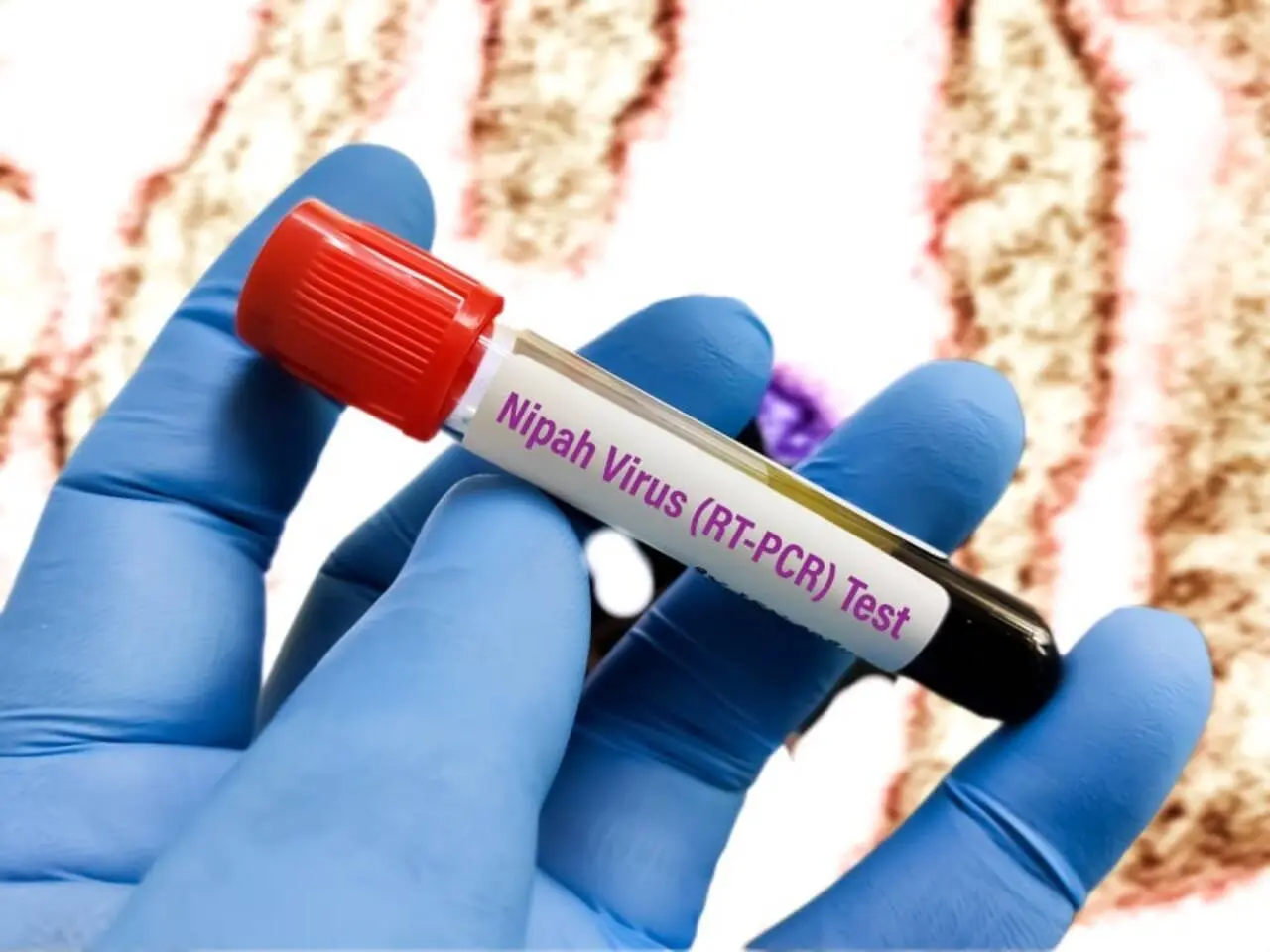 Nipah virus