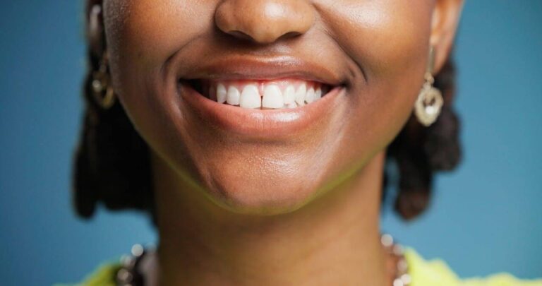 dente sorriso
