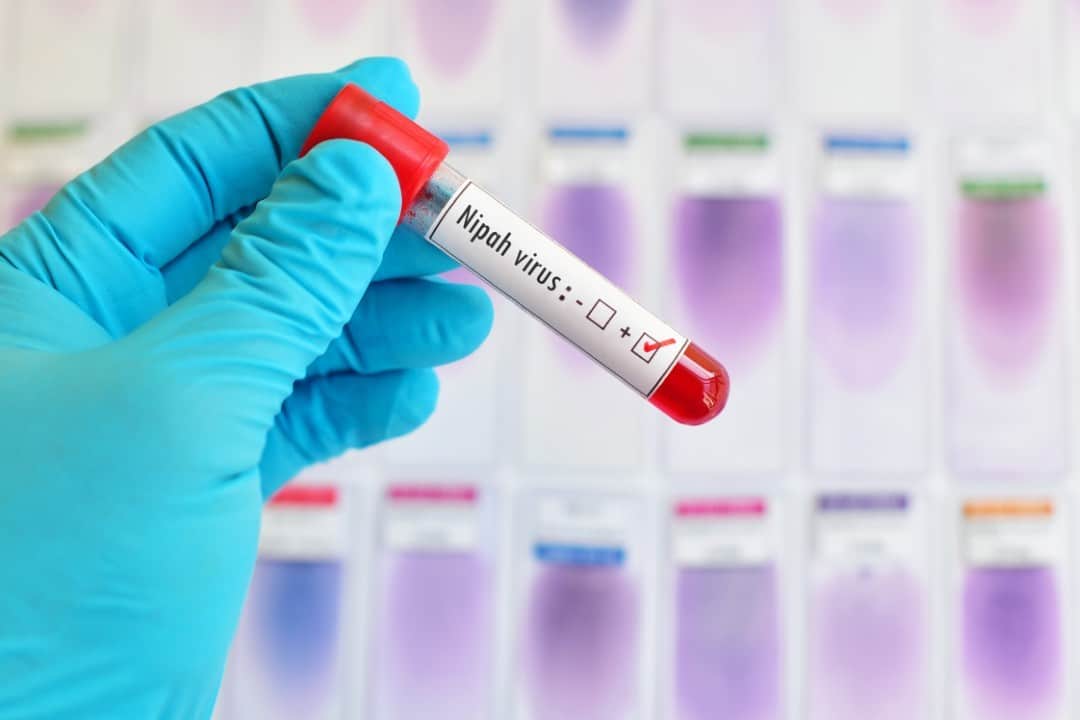 nipah virus