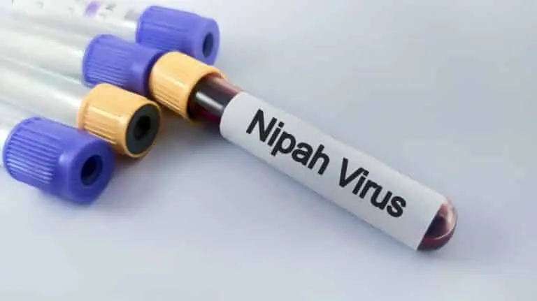 vírus Nipah
