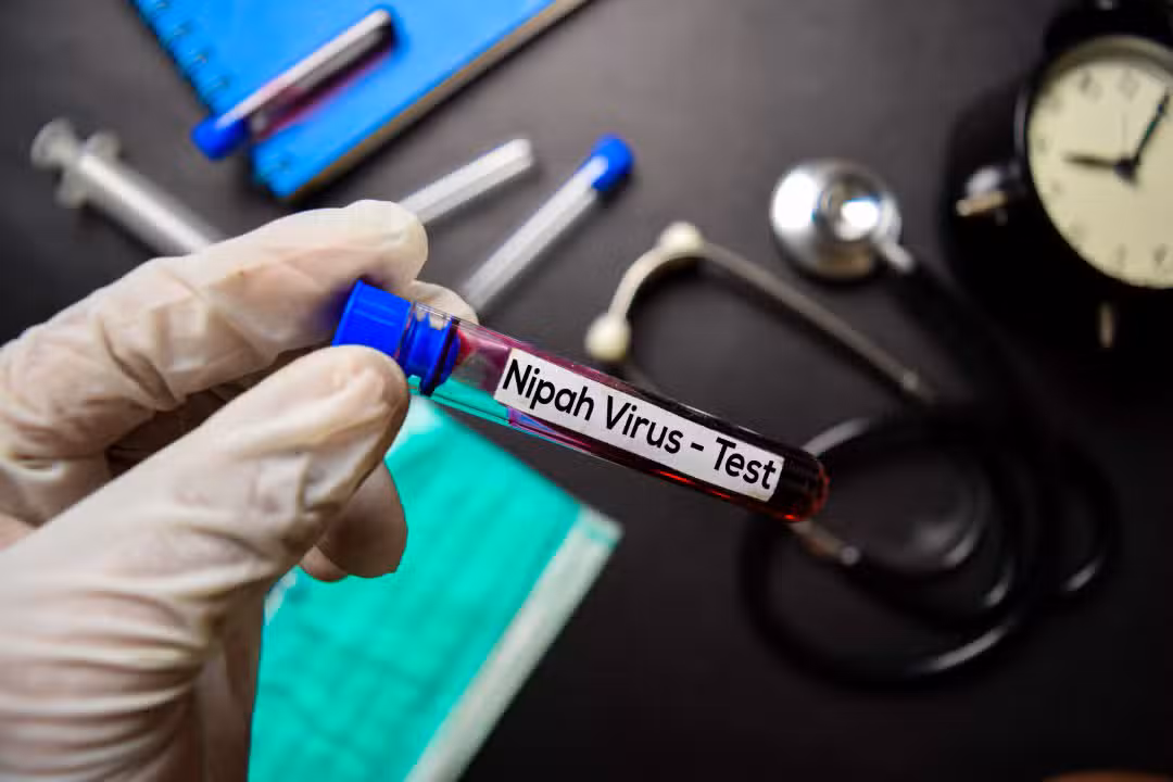Vírus Nipah