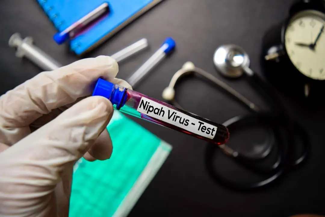 V&iacute;rus Nipah