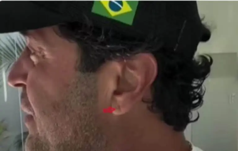 marca semelhante ao sinal de Frank na orelha de Henrique Maderite - Rede Social