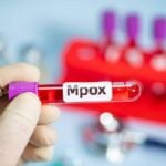 mpox