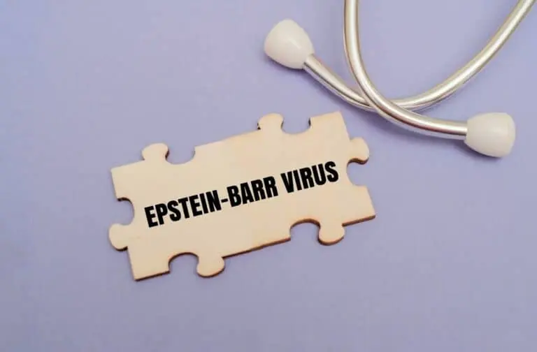 vírus Epstein-Barr