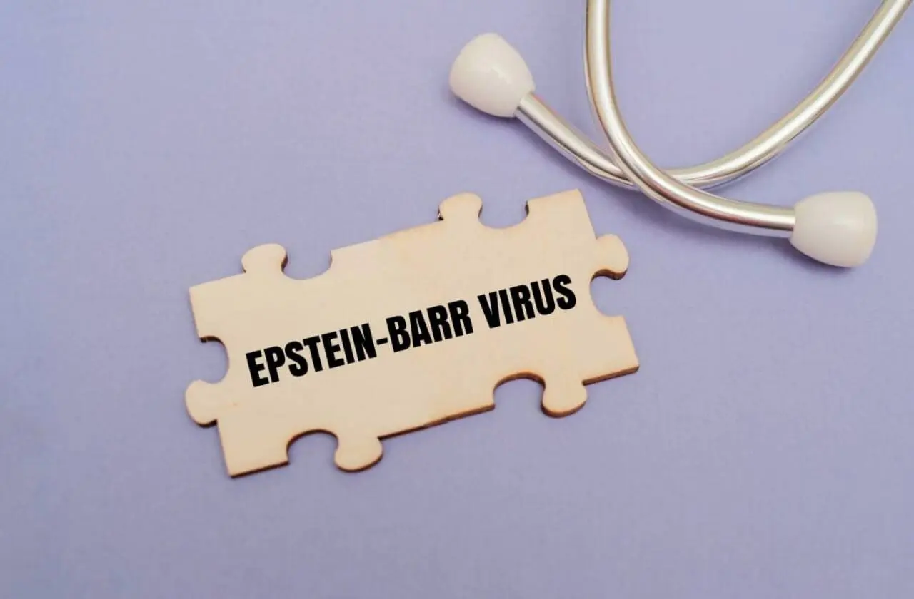vírus Epstein-Barr