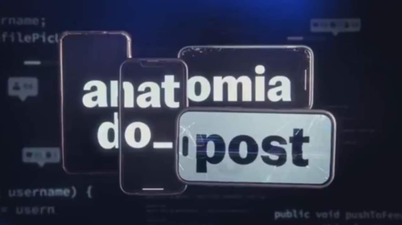 Anatomia do Post