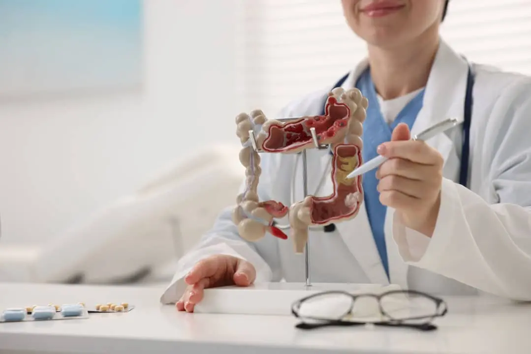Câncer de intestino