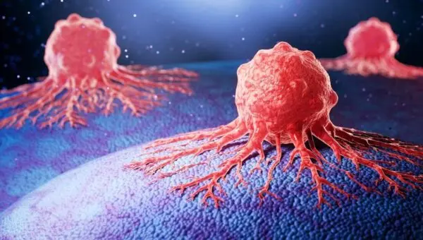 Células cancerosas no tecido humano, câncer.