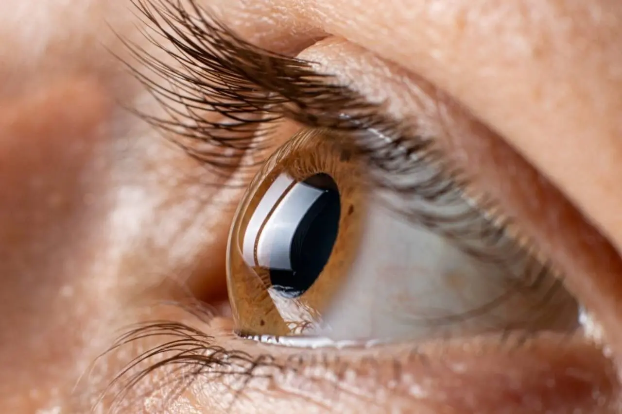 cornea, eyes