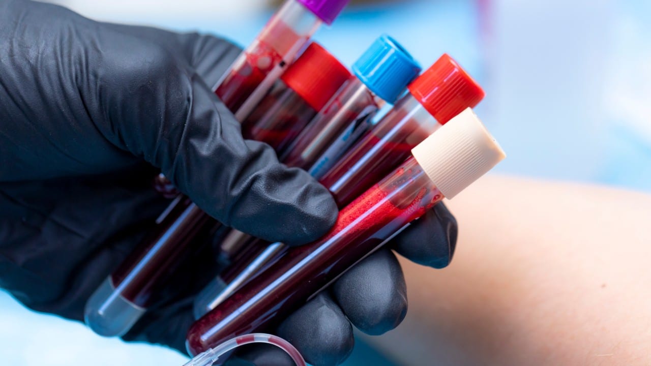 Tubos de sangue humano