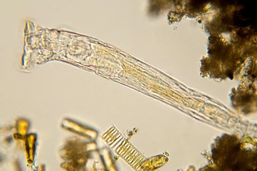 Imagem de bichinhos microscópicos Rotífero