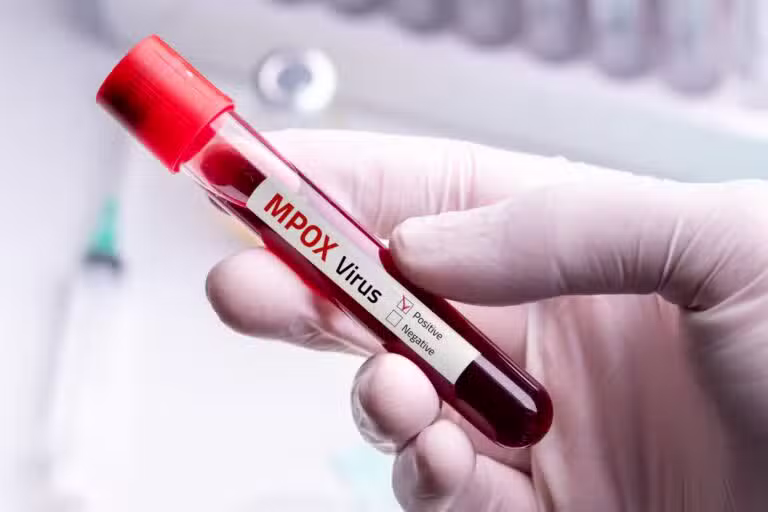 Vírus mpox