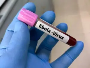 Demokratik Kongo Cumhuriyeti, madencilik alanında 65 ölümle yeni Ebola salgını kaydetti