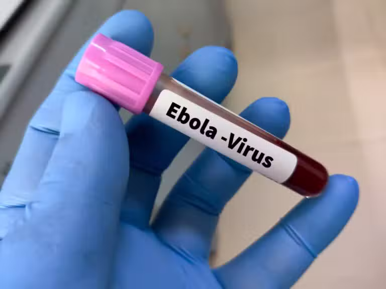 Ebola teste