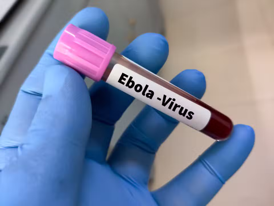Ebola teste
