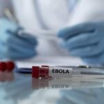 Secretaria de Saúde de São Paulo apura suspeita de ebola em paciente que viajou para área de surto na África Central