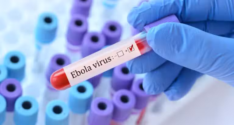 Ebola vírus
