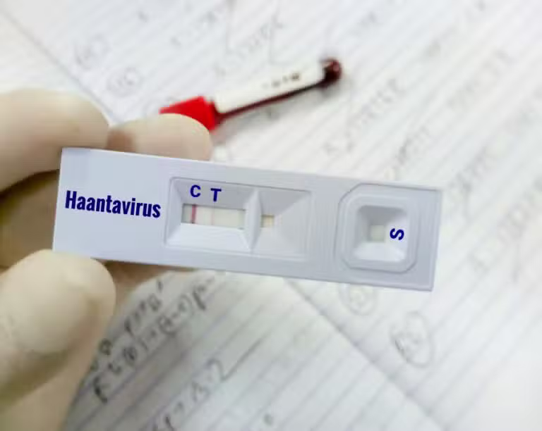 Teste rápido de hantavírus positivo