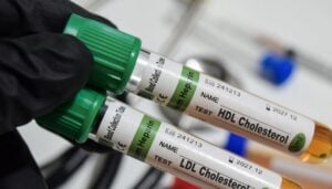 العلاج التجريبي لتحرير الجينات يقلل من نسبة الكولسترول LDL بنسبة تصل إلى 62% بجرعة واحدة
