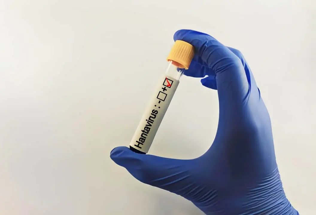 hantavirus