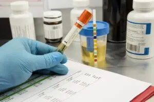 Exame toxicológico obrigatório para primeira CNH nas categorias A e B começa a valer em todo o Brasil