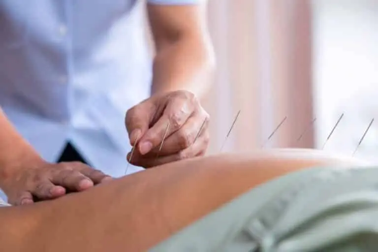 Tratamento de acupuntura