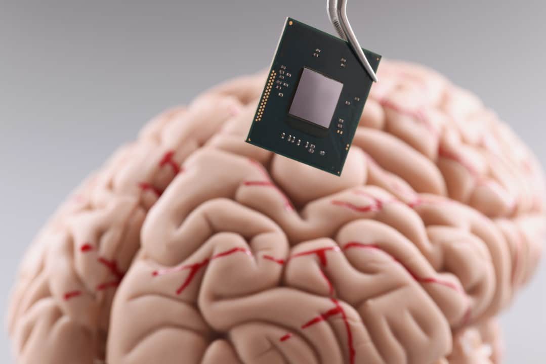 chip cerebral