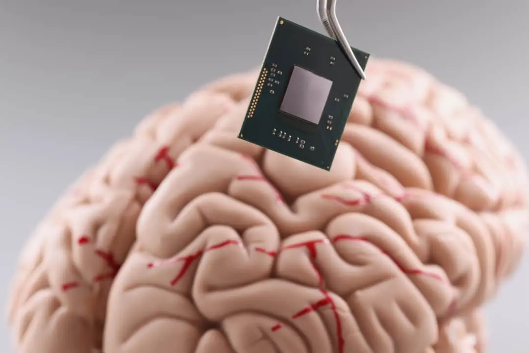chip cerebral