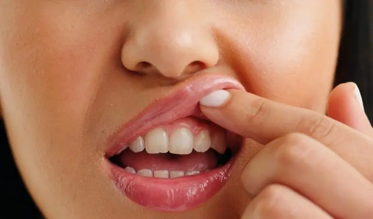 Dentes gengiva