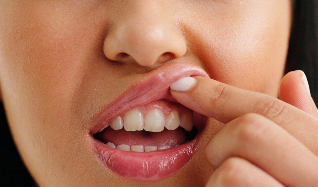 Dentes gengiva