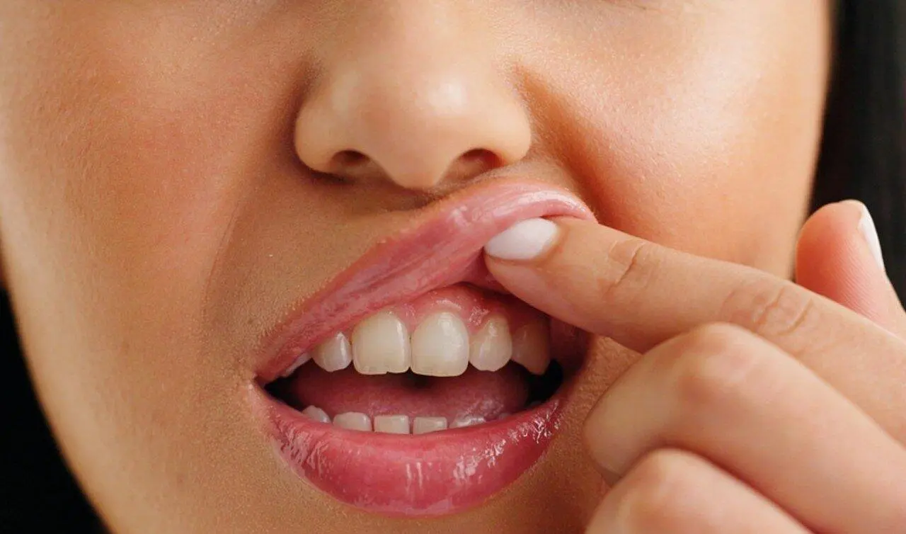 Dentes gengiva