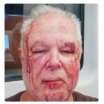 Idoso relata agressão em Copacabana com ofensas políticas e religiosas; Polícia Civil investiga caso no Rio