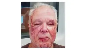 Idoso relata agressão em Copacabana com ofensas políticas e religiosas; Polícia Civil investiga caso no Rio