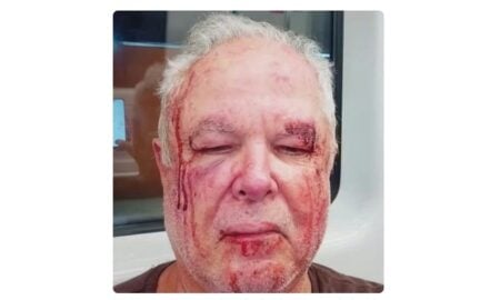 Idoso agredido em copacabana