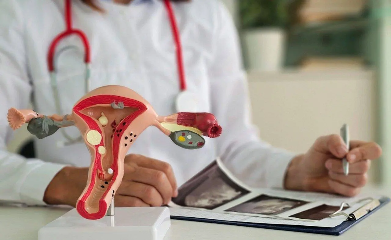 Ovários Endometriose - Nadzeya Haroshka/Istock.com