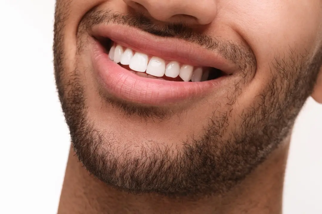 sorriso, boca, dente