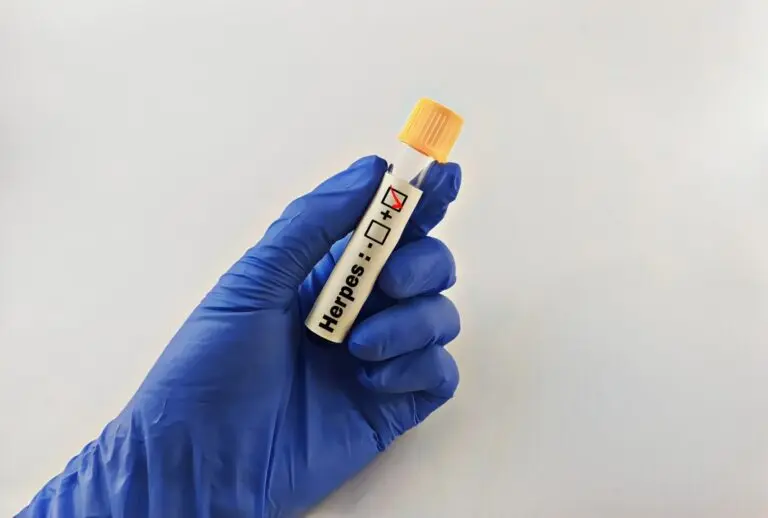 vírus da herpes