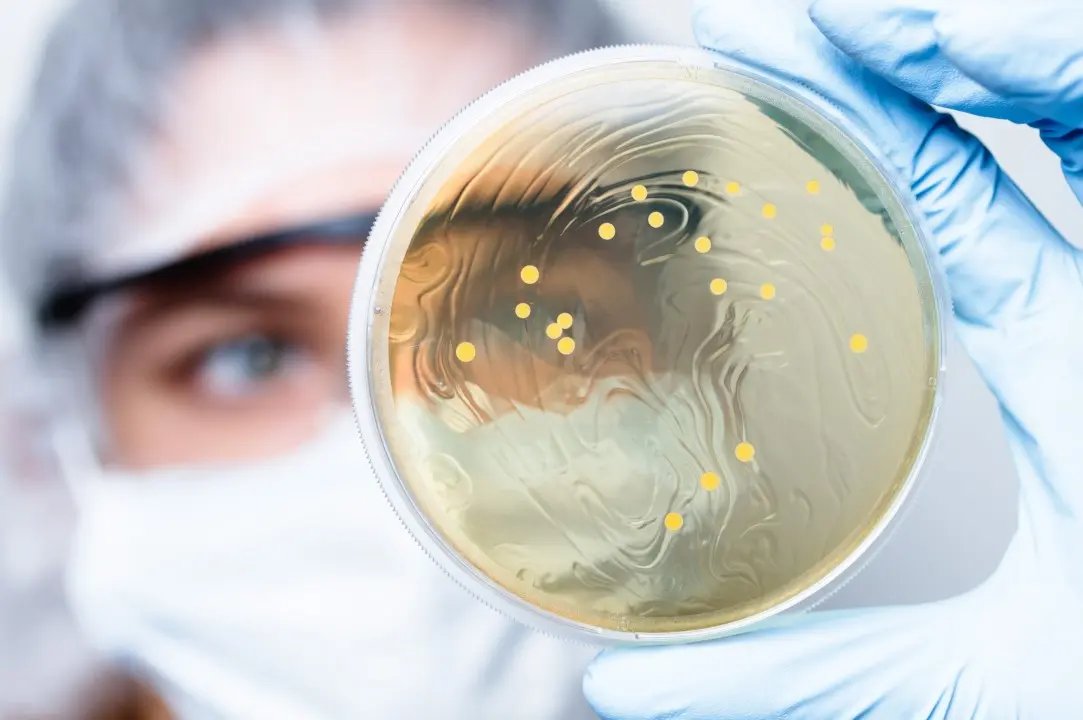 Estudo cientifico, cientista, colônias de bactérias