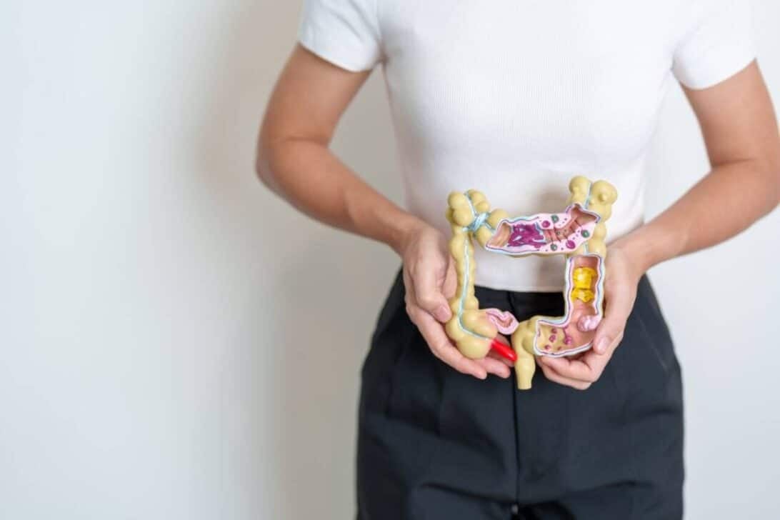 Modelo anatômico do cólon humano, Conceito doenças do cólon, intestino grosso, câncer colorretal
