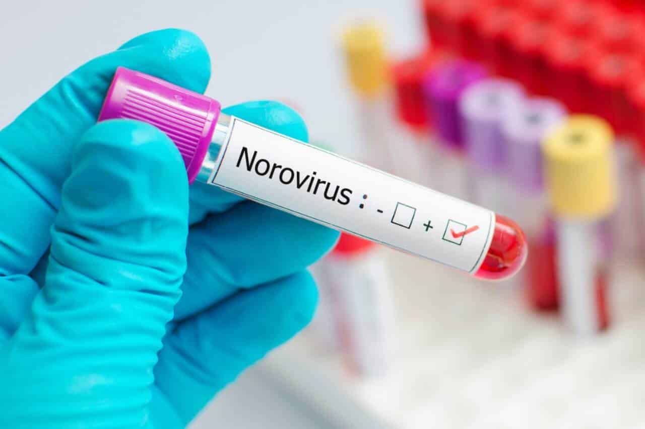 Norovírus