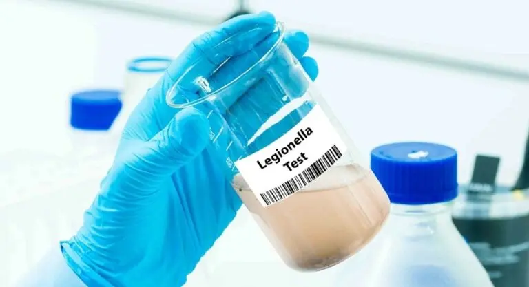 Bactéria Legionella - luchschenF/Shutterstock.com