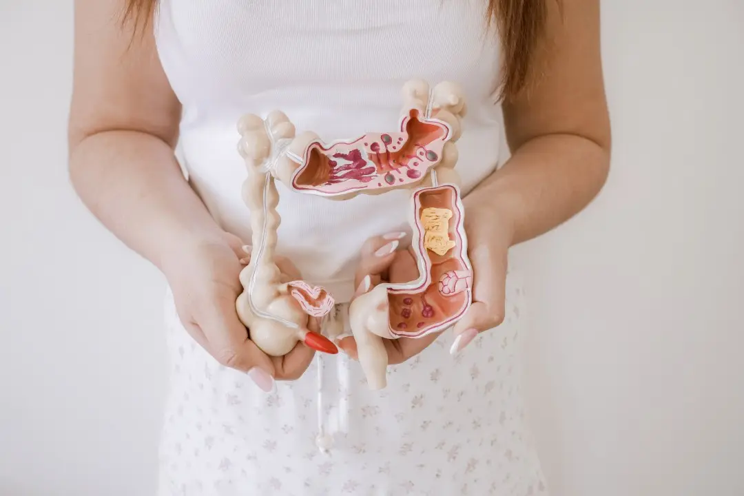 câncer de intestino