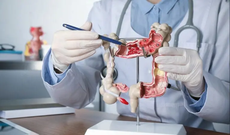 câncer de intestino - Liudmila Chernetska/Istock.com