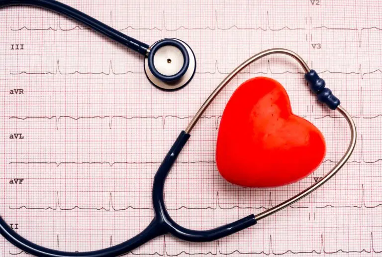 Estetoscópio e bolinha de massagem em formato de coração em cima de um eletrocardiograma